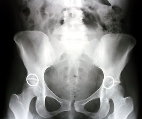 Image showing X-ray photograph