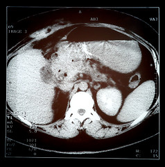 Image showing Sonograph