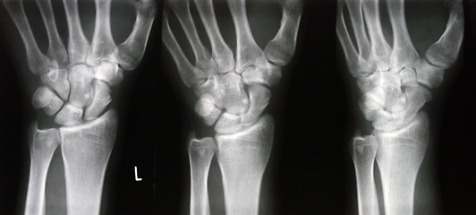 Image showing X-ray photograph