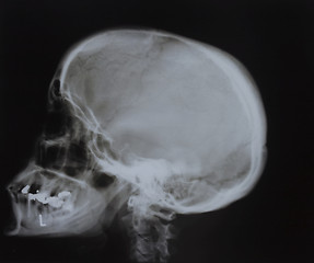 Image showing X-ray photograph