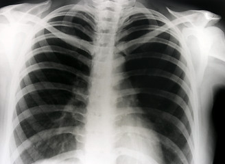 Image showing X-ray photograph