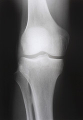 Image showing X-ray photograph