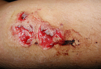 Image showing wound,graze