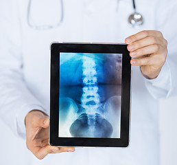 Image showing male doctor holding tablet pc with x-ray