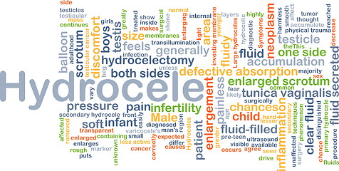 Image showing Hydrocele background concept