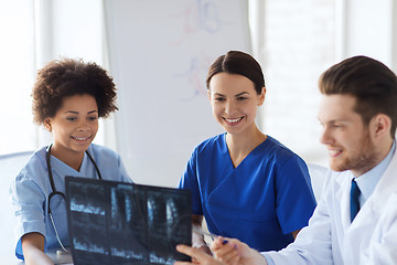 Image showing group of happy doctors discussing x-ray image