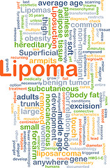 Image showing Lipoma background concept