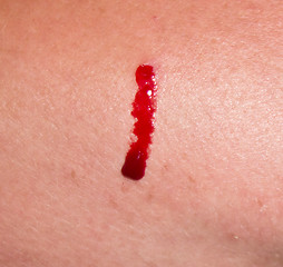 Image showing blood