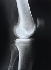 Image showing X-ray