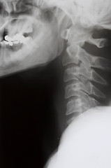 Image showing X-ray