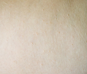 Image showing human skin