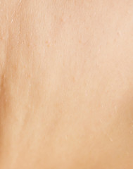 Image showing wrinkled skin