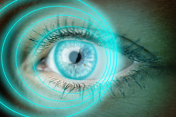 Image showing eye with blue rings