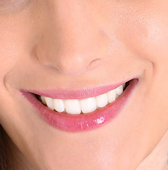 Image showing closeup of smile with white healthy teeth