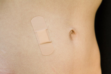 Image showing band aid belly