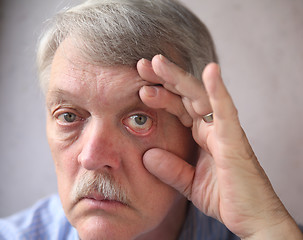 Image showing bloodshot eyes in a senior man 