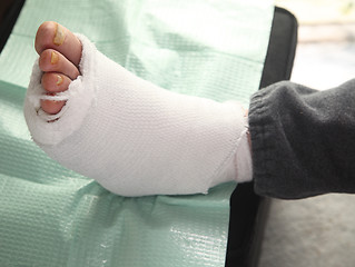 Image showing diabetic foot injury