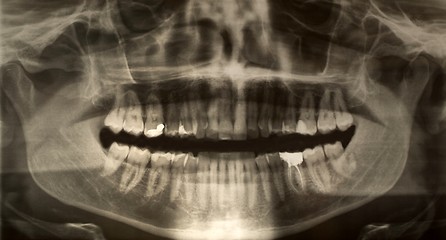 Image showing Dental x-ray