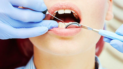 Image showing Close-up of a pretty patient with her mouth open