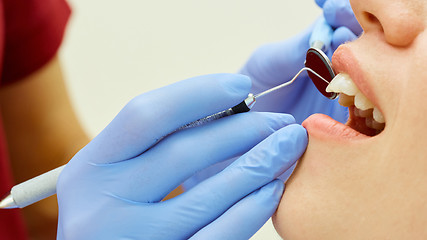 Image showing Examining teeth