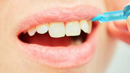 Image showing the correct use of a tooth brush for perfect oral hygiene