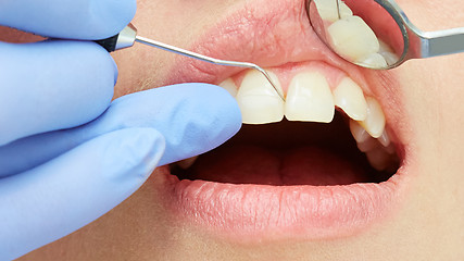 Image showing Examining patient&#39;s teeth