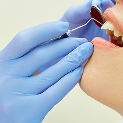 Image showing Examining teeth