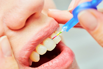 Image showing the correct use of a tooth brush for perfect oral hygiene