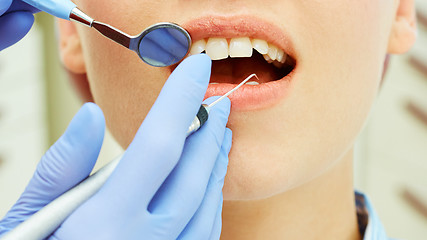 Image showing Examining teeth