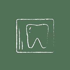 Image showing X-ray of the tooth icon drawn in chalk.