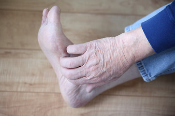 Image showing man with rash on foot