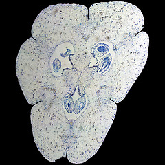 Image showing Lily ovary micrograph