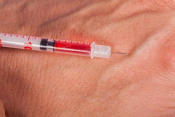 Image showing Subcutaneous medical injection concept