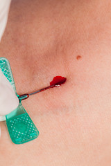 Image showing Subcutaneous medical injection concept