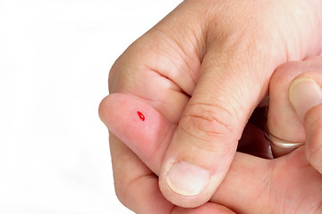 Image showing Thumb from a Bloody Finger