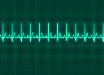 Image showing Electrocardiography