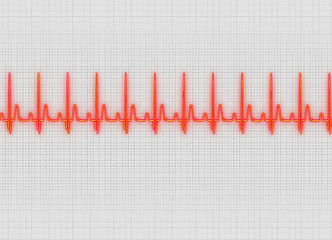 Image showing Electrocardiography