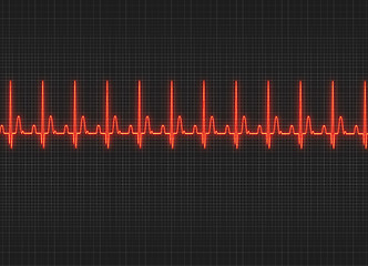 Image showing Electrocardiography