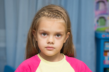Image showing Upset five year old girl with tearful eyes