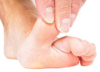 Image showing Male person pulling big toe backwards isolated towards white