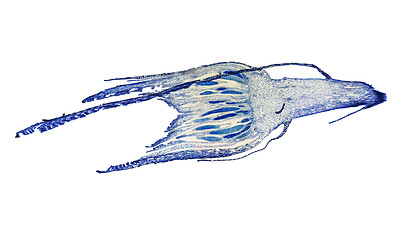 Image showing Moss protonemata micrograph