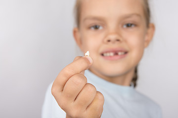 Image showing Six year old girl showing her fallen front upper teeth