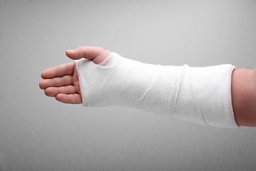 Image showing broken arm bone in cast 