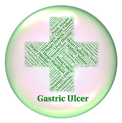 Image showing Gastric Ulcer Means Open Sore And Cyst