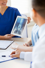 Image showing close up of happy doctors with x-ray at hospital