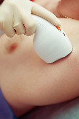 Image showing male laser epilation