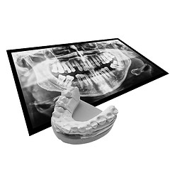 Image showing Black and white Xray of teeth with positive teeth cast