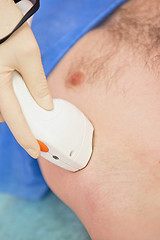 Image showing male laser epilation