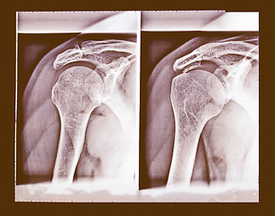 Image showing  Xray vintage