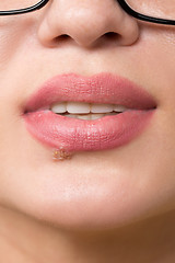 Image showing beautiful lips virus infected herpes